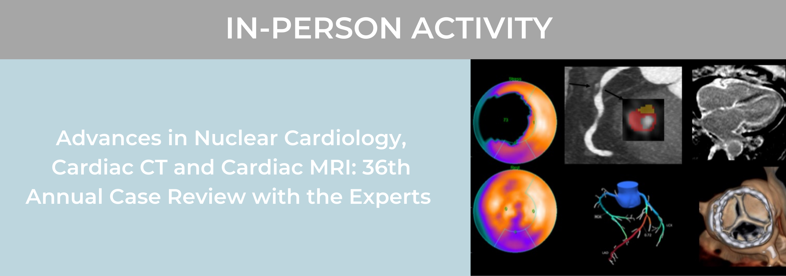 POSTPONED-Advances in Nuclear Cardiology, Cardiac CT and Cardiac MRI: 36th Annual Case Review with the Experts Banner